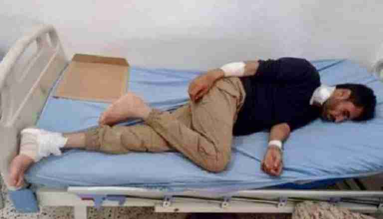 عاجل. إصابة ثلاثة مدنيين بقصف طائرة مسيرة حوثية شمال الضالع