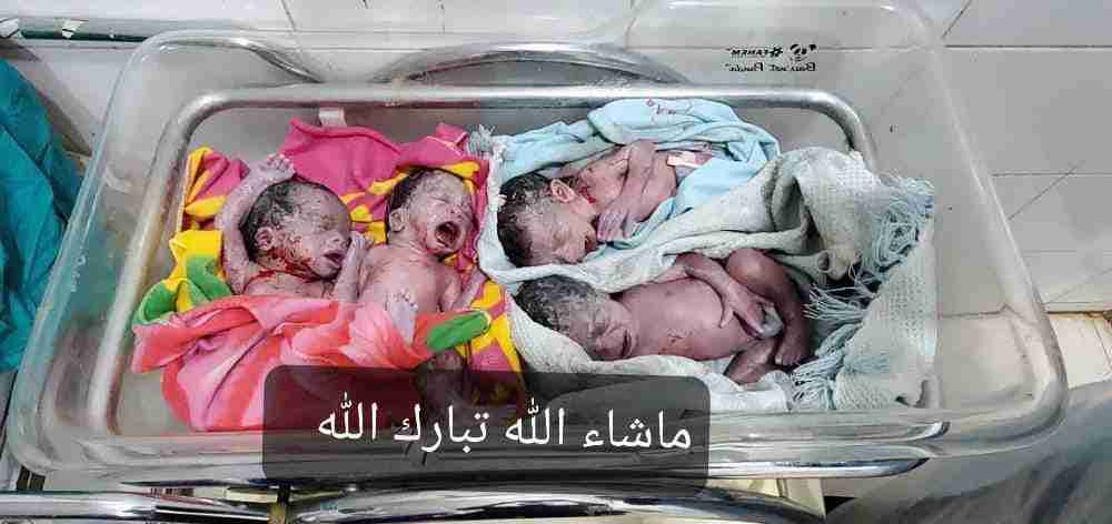 شبوة. ولادة اربع توائم بعملية قيصرية في مستشفى شبوة العام للأمومه والطفولة.