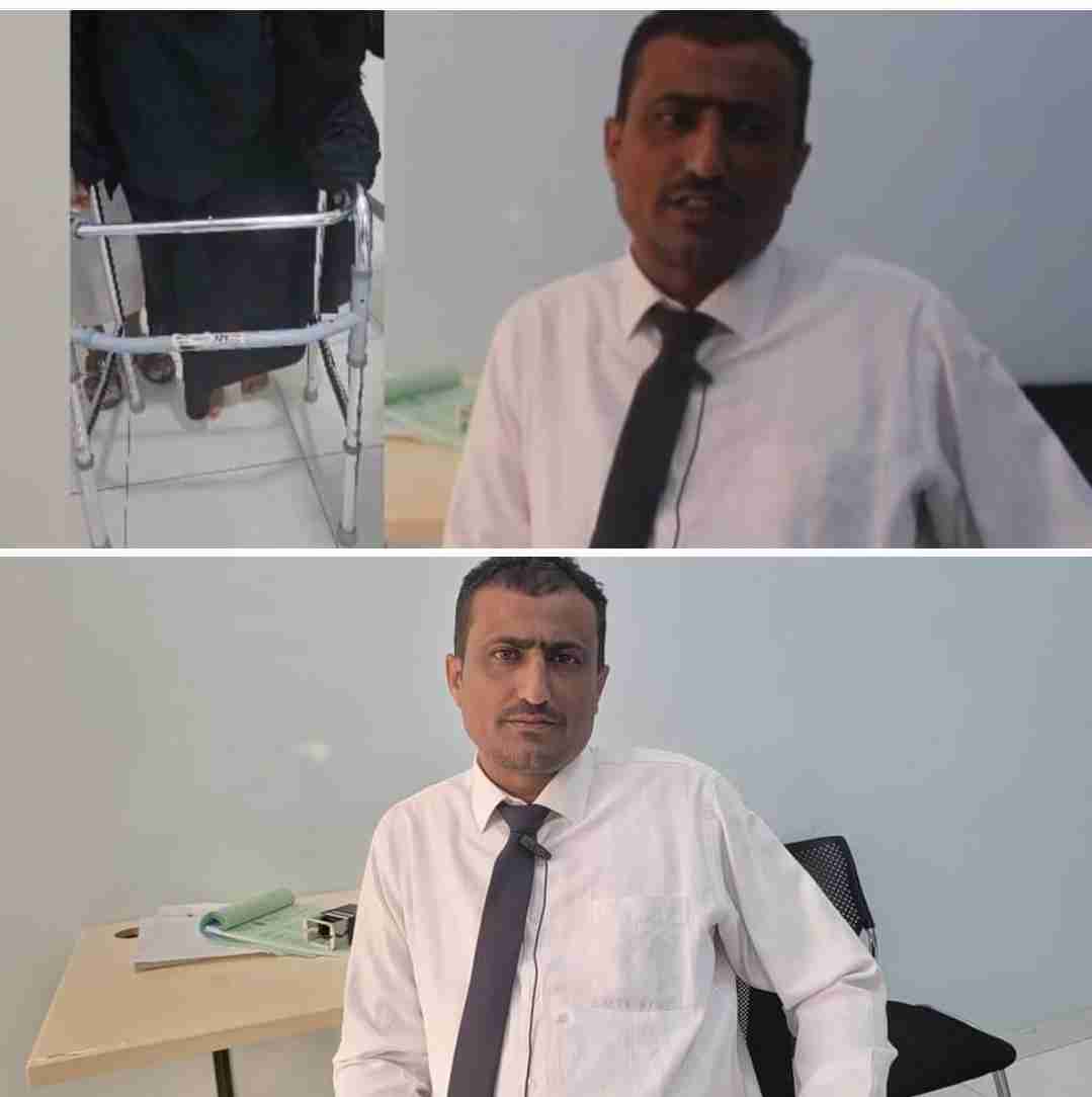 إجراء عملية تركيب مفصل اصطناعي لإمرأة في هيئة مستشفى شبوة العام